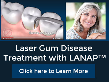 Laser Gum Disease Treatment with LANAP